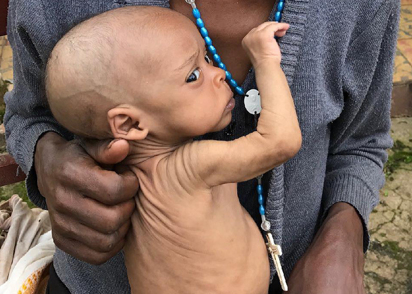 We must Help! somalia